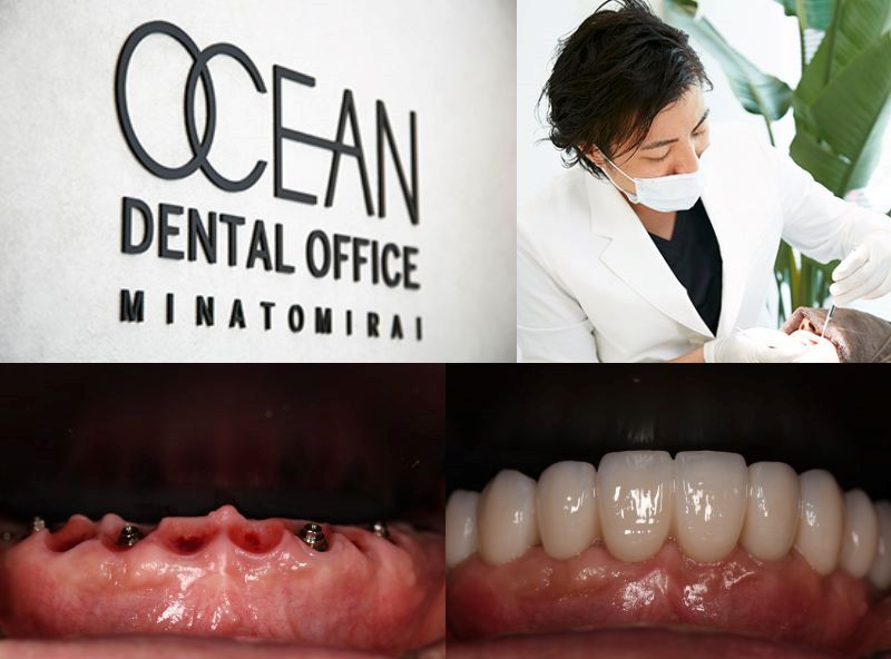 OCEAN DENTAL OFFICE MINATOMIRAI