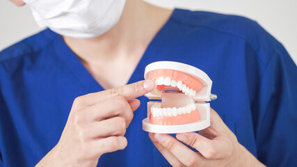 インプラントの歯周病はありますか？