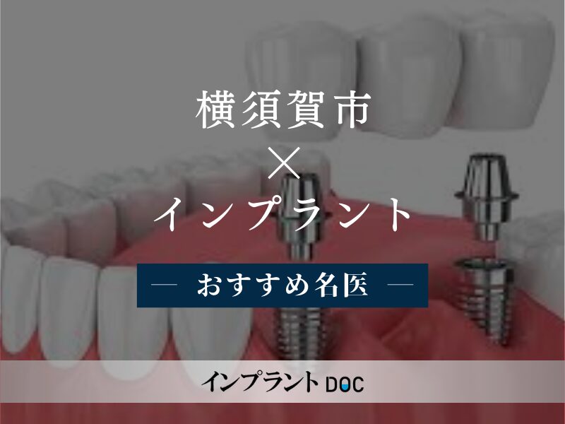 横須賀市 インプラント　おすすめ名医