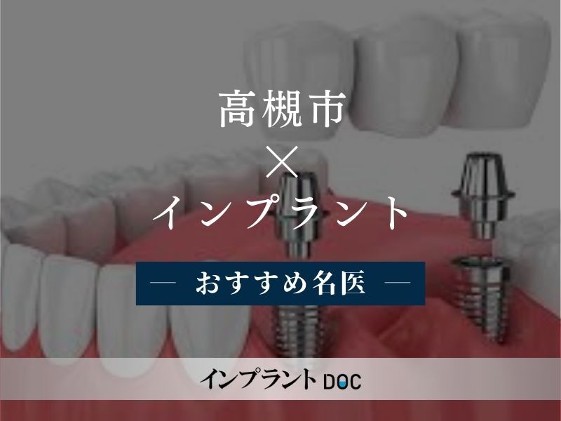 高槻市 インプラント　おすすめ名医