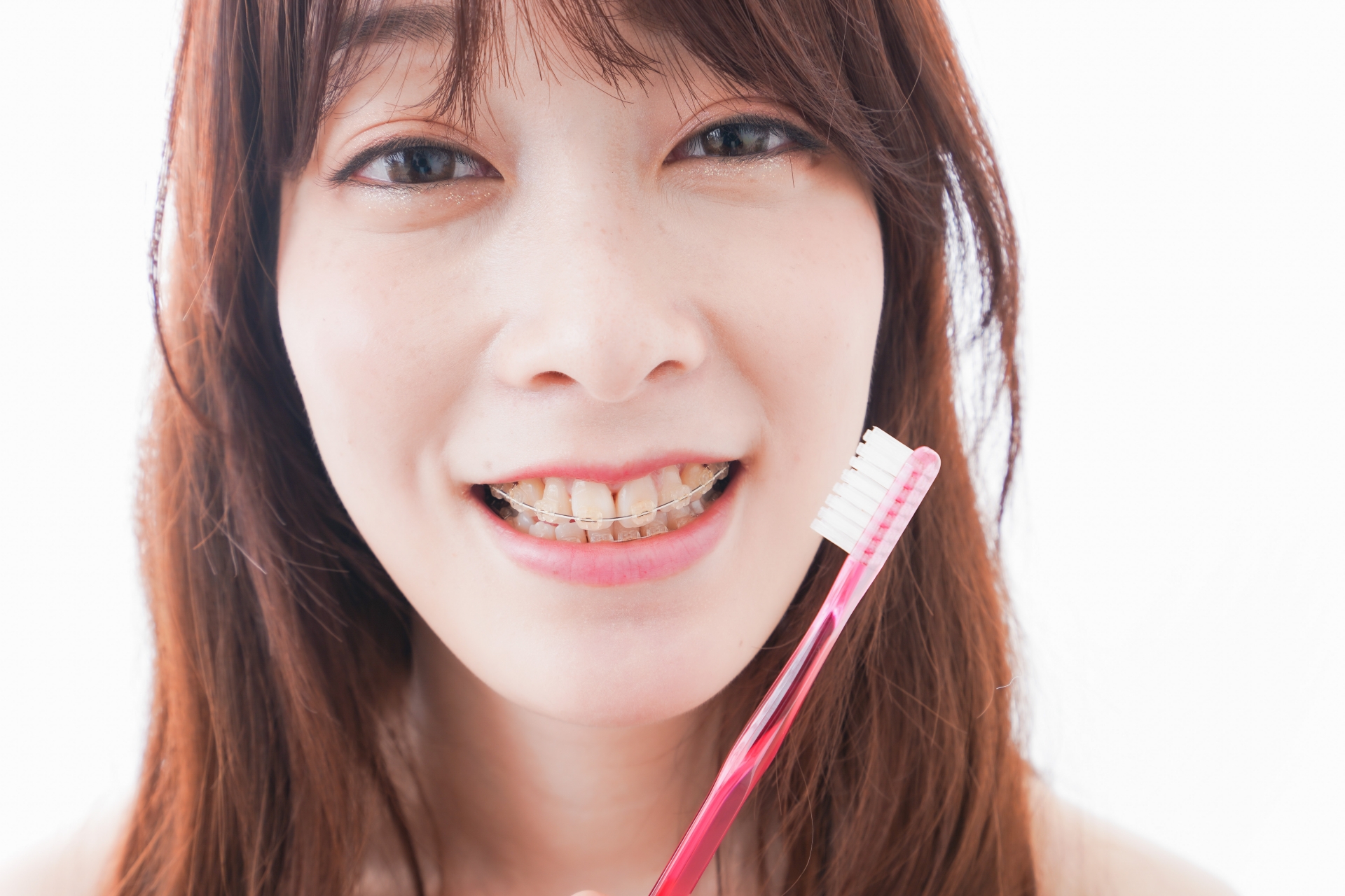 歯列矯正をする若い女性