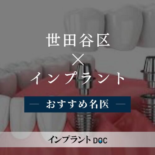 世田谷区おすすめのインプラントの名医9人 - インプラントDOC