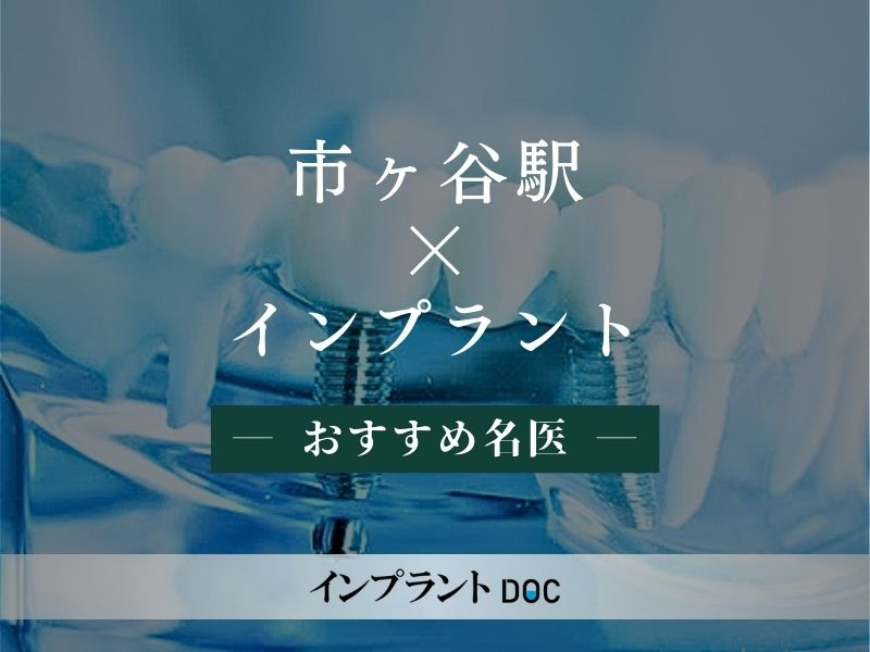 市ヶ谷駅おすすめのインプラントの名医