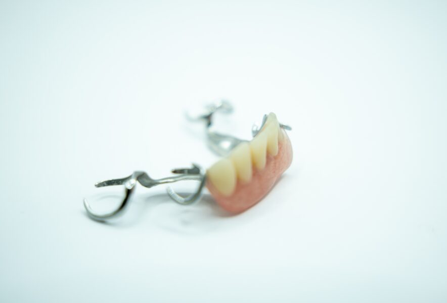 差し歯と入れ歯の違いは何？それぞれのメリットとデメリットも紹介！