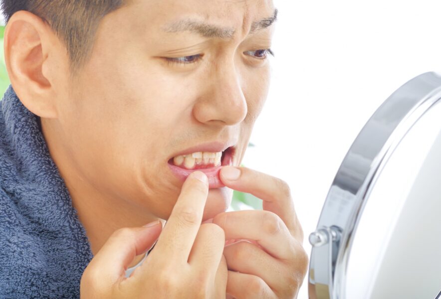 大人になって歯が抜けたらどうする？応急処置や放置するリスクを解説