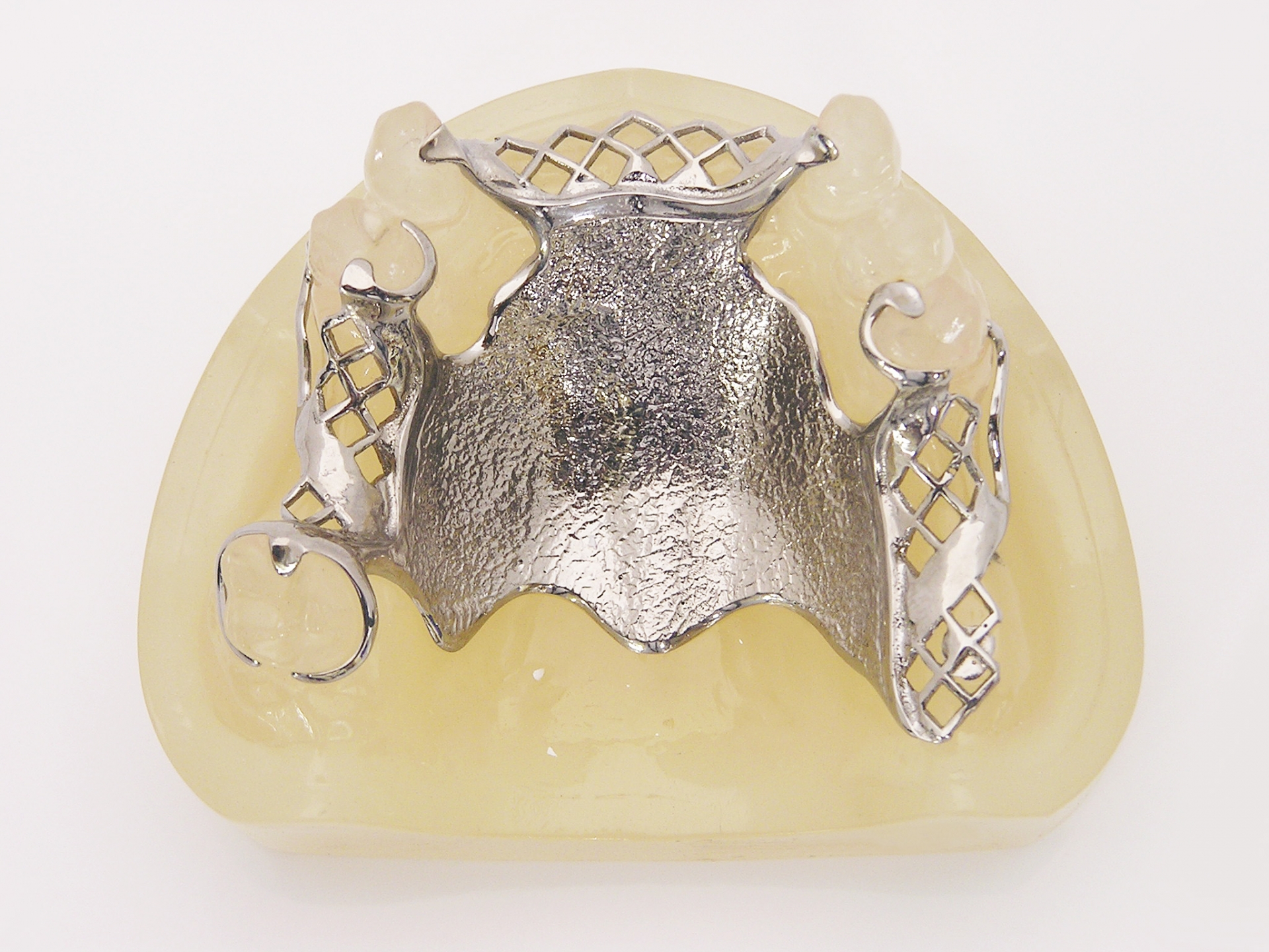 金属床義歯の特徴やメリットについて