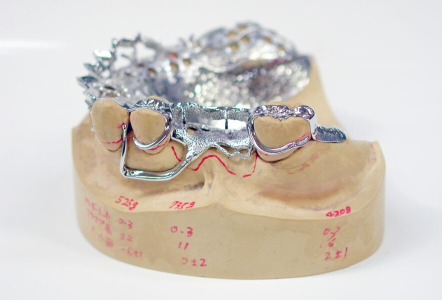 金属床義歯の特徴やメリットとは？プラスチック入れ歯との違いや値段も解説！