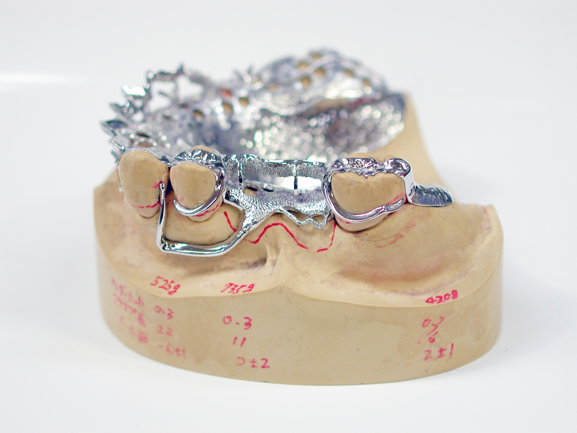 金属床義歯の特徴やメリットとは？プラスチック入れ歯との違いや値段も