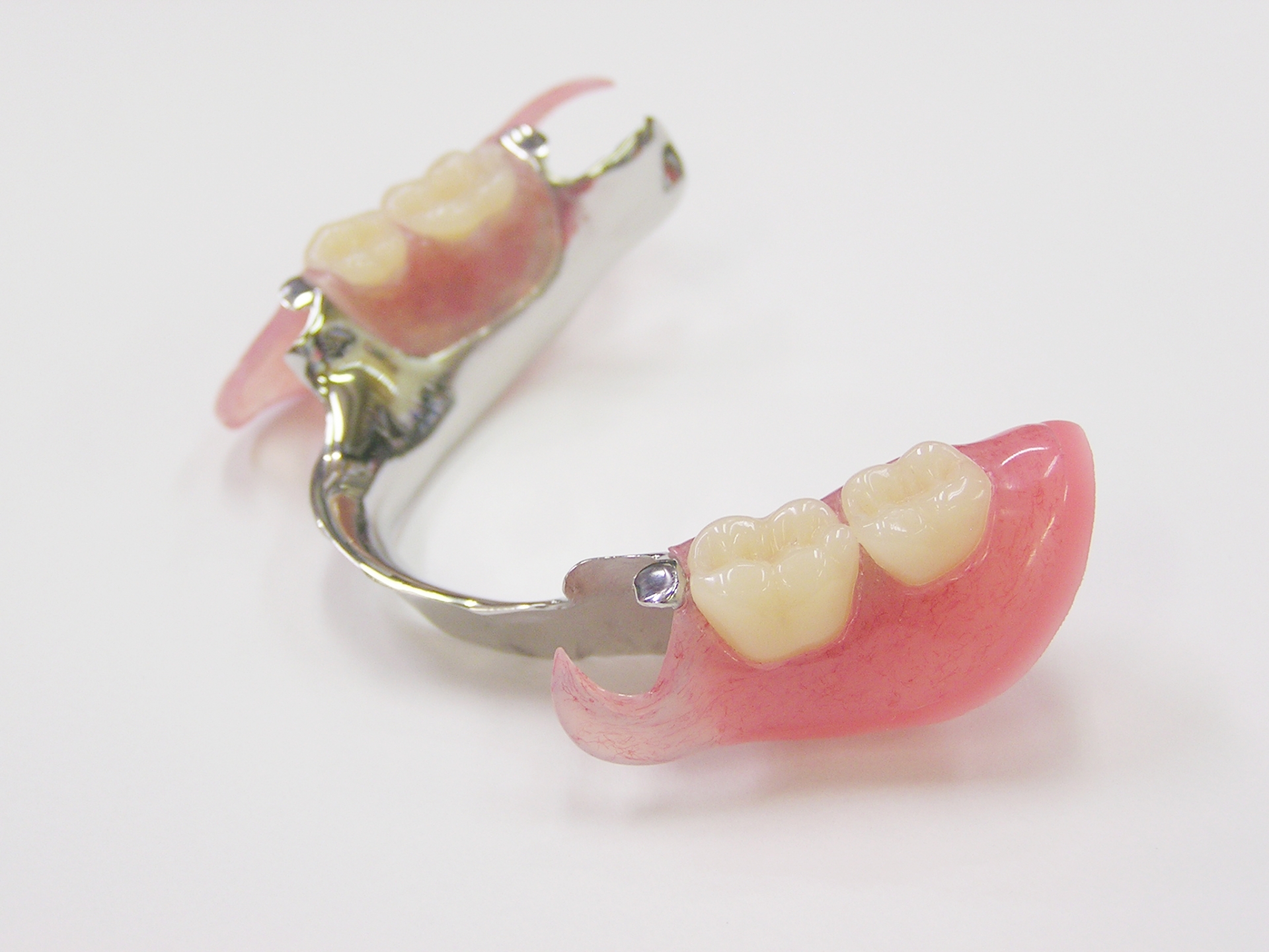 金属床とプラスチックの入れ歯の違いについて