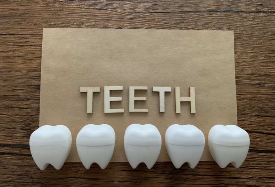 差し歯の寿命は意外と短い？知っておくべきポイントや寿命を延ばす方法をまとめました