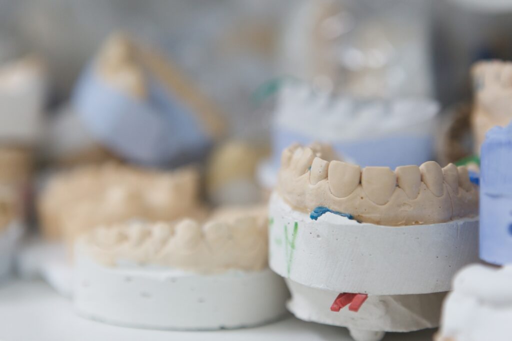歯の石膏模型