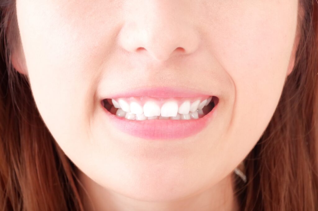 笑顔で歯を強調する女性