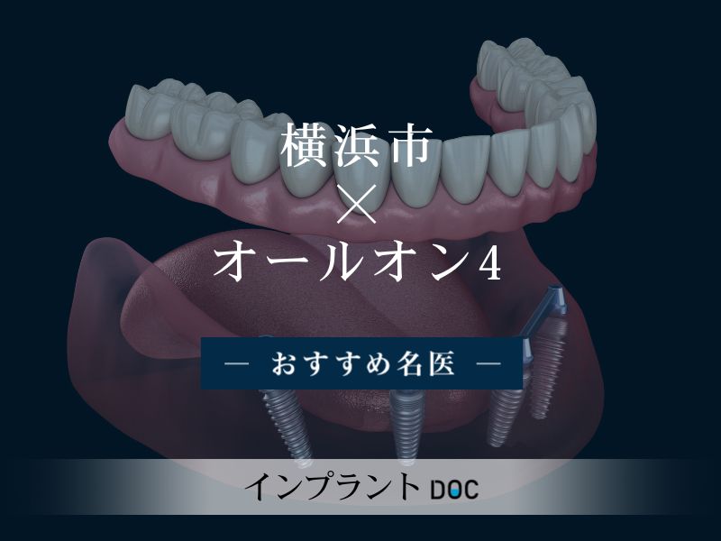 横浜市おすすめのオールオン4の名医