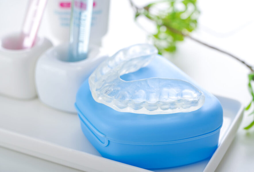 インプラント治療後にマウスピースを使用するメリットやデメリットを紹介